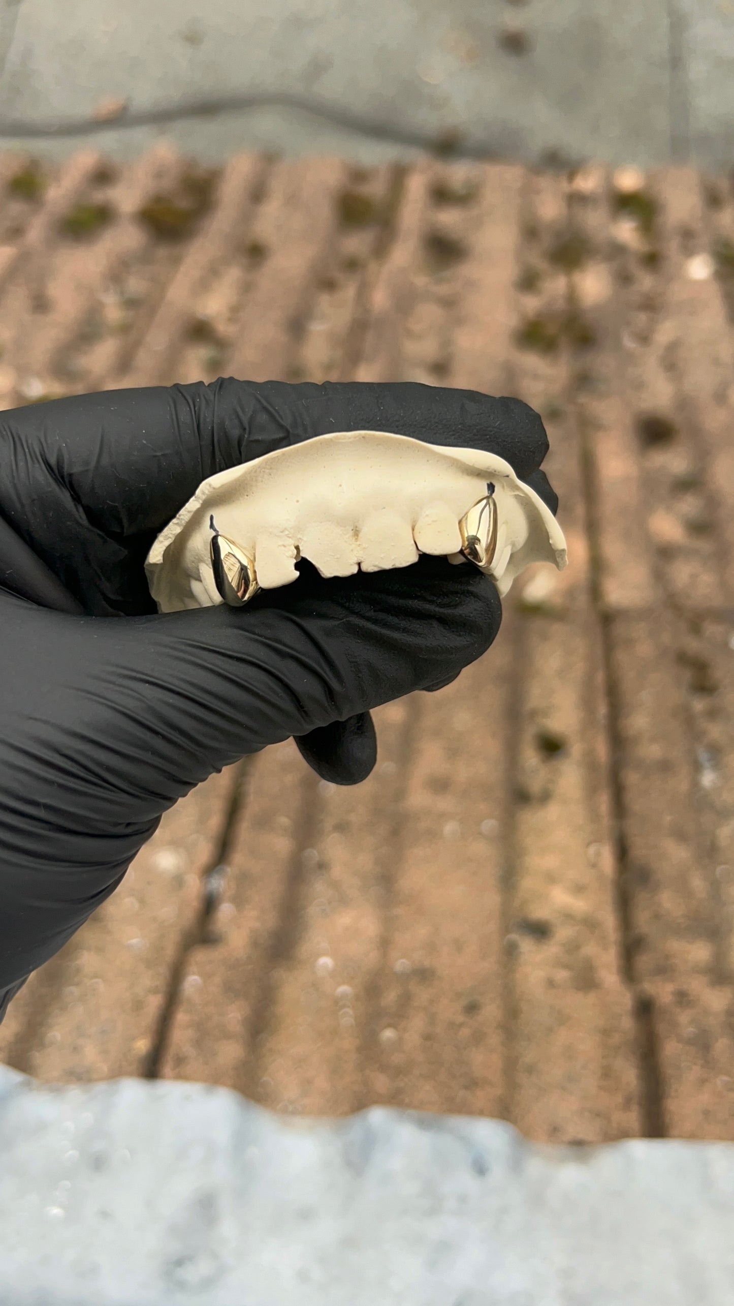 2x Dental Gold
