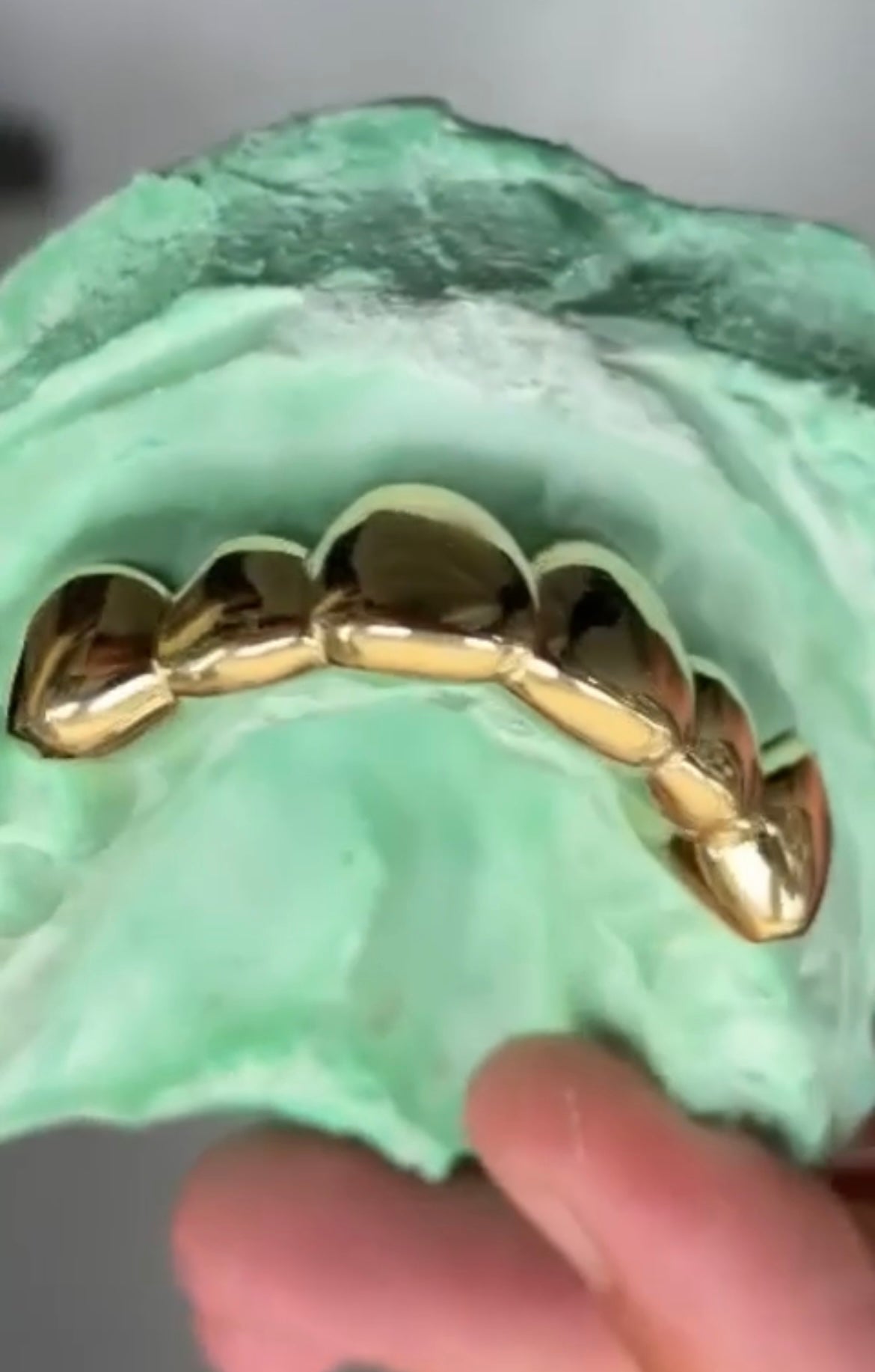 6x Dental Gold