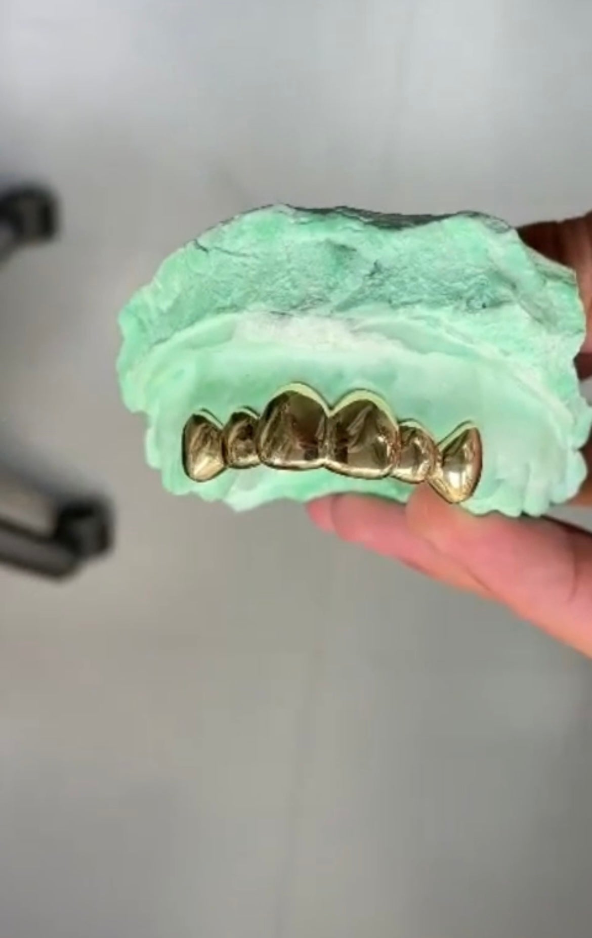6x Dental Gold