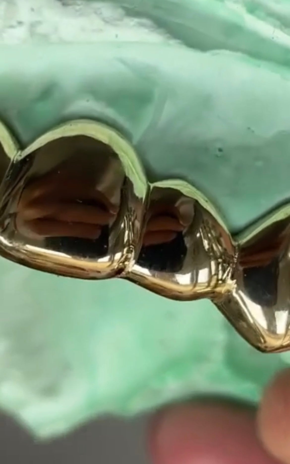 6x Dental Gold